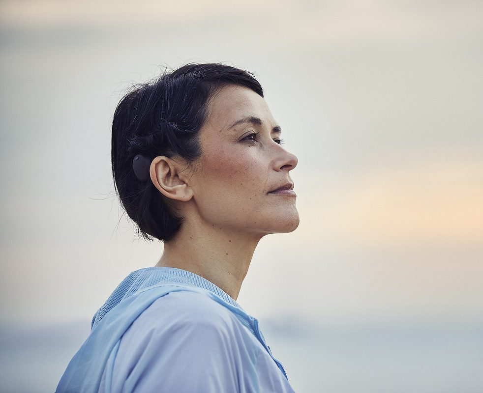 Woman wearing a cochlear implant device A young woman wearing a cochlear implant device